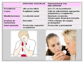 9-40%
Prolongación en los tiempos de
coagulación

Enfermedad de
Willebrand

 