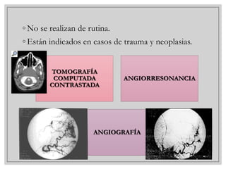◦ No se realizan de rutina.
◦ Están indicados en casos de trauma y neoplasias.
TOMOGRAFÍA
COMPUTADA
CONTRASTADA

ANGIORRESONANCIA

ANGIOGRAFÍA

 