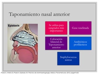 Taponamiento nasal anterior
Se utiliza para
sangrados más
importantes

Gasa vaselinada

Colocación
bilateral de
Taponamiento
anterior

Antibióticos
profilácticos

Staphylococcus
aureus

Prado C, Arrieta G, Prado A, Epistaxis. En: Práctica de otorrinolaringología, México: Panamericana; 2012, pág647-655

 
