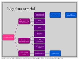 Ligadura arterial
Pared posterior
antral expuesta
Transantral de
ramas de la arteria
maxilar interna

Cadwell-Luc

Clips
autoajustables

75-90%

Epistaxis
anteriores
Ligadura Arterial
Etmoidales
anterior y posterior

Etmoidales no
controladas
Etmoidectomía
externa

Arteria carótida
externa

Abordaje cervical

Poco exitoso

Prado C, Arrieta G, Prado A, Epistaxis. En: Práctica de otorrinolaringología, México: Panamericana; 2012, pág647-655

Fosa
pterigomaxilar

 