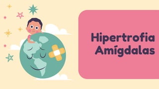 Hipertrofia
Amígdalas
 
