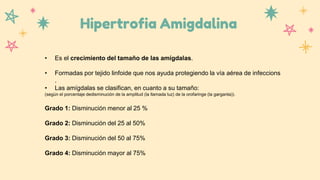 Hipertrofia Amigdalina
• Es el crecimiento del tamaño de las amígdalas.
• Formadas por tejido linfoide que nos ayuda protegiendo la vía aérea de infeccions
.
• Las amígdalas se clasifican, en cuanto a su tamaño:
(según el porcentaje dedisminución de la amplitud (la llamada luz) de la orofaringe (la garganta)).
Grado 1: Disminución menor al 25 %
Grado 2: Disminución del 25 al 50%
Grado 3: Disminución del 50 al 75%
Grado 4: Disminución mayor al 75%
 