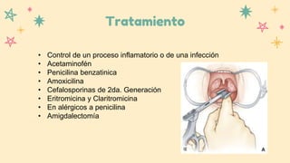 Tratamiento
• Control de un proceso inflamatorio o de una infección
• Acetaminofén
• Penicilina benzatinica
• Amoxicilina
• Cefalosporinas de 2da. Generación
• Eritromicina y Claritromicina
• En alérgicos a penicilina
• Amigdalectomía
 