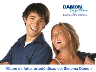 Experience the Difference™
Álbum de fotos ortodónticas del Sistema Damon
 