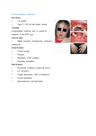 Oro-facial-digital syndromes
Prevalence
• 1 in 50,000
• Types I - VIII, all with similar features
Aetiology
Orofaciodigital syndrome type 1 is caused by
mutations in the OFD1 gene.
General signs
• Digital anomalies: brachydactyly, syndactyly,
polydactyly
Facial features
• Frontal bossing,
• Euryopia,
• Hypoplasia of alar cartilages
• Zygomatic hypoplasia
Oral features
• Pseudocleft of midline of upper lip (45%)
• CP - SP (80%)
• Tongue hamartomas, clefts or lobulations
• Fraenal hyperplasia
• Supernumeraries and hypodontia
 
