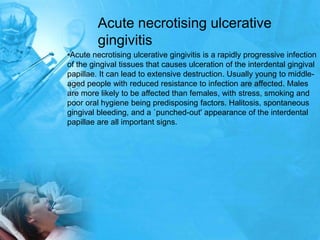 Acute necrotising ulcerative
         gingivitis
•Acute necrotising ulcerative gingivitis is a rapidly progressive infecti...