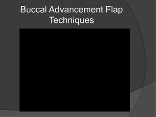 Buccal Advancement Flap
Techniques
 