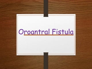 Oroantral Fistula
 