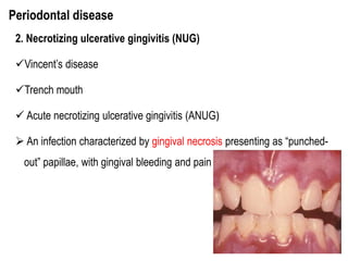 Orodental | PPTX