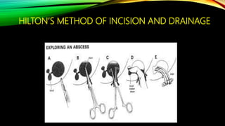 Orofacial infection part 1 | PPTX