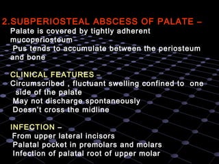 Palatal Infection Oro facial infections__oral_surgery_ | PPT