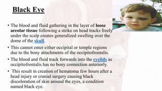 Black Eye
• The blood and fluid gathering in the layer of loose
areolar tissue following a strike on head tracks freely
under the scalp creates generalized swelling over the
dome of the skull.
• This cannot enter either occipital or temple regions
due to the bony attachments of the occipitofrontalis.
• The blood and fluid track forwards into the eyelids as
occipitofrontalis has no bony connection anteriorly.
• This result in creation of hematoma few hours after a
head injury or cranial surgery causing black
discoloration of skin around the eyes, a condition
named black eye.
 