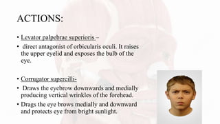 ACTIONS:
• Levator palpebrae superioris –
• direct antagonist of orbicularis oculi. It raises
the upper eyelid and exposes the bulb of the
eye.
• Corrugator supercilli-
• Draws the eyebrow downwards and medially
producing vertical wrinkles of the forehead.
• Drags the eye brows medially and downward
and protects eye from bright sunlight.
 
