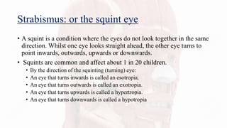 Strabismus: or the squint eye
• A squint is a condition where the eyes do not look together in the same
direction. Whilst one eye looks straight ahead, the other eye turns to
point inwards, outwards, upwards or downwards.
• Squints are common and affect about 1 in 20 children.
• By the direction of the squinting (turning) eye:
• An eye that turns inwards is called an esotropia.
• An eye that turns outwards is called an exotropia.
• An eye that turns upwards is called a hypertropia.
• An eye that turns downwards is called a hypotropia
 