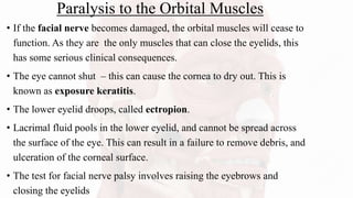 Paralysis to the Orbital Muscles
• If the facial nerve becomes damaged, the orbital muscles will cease to
function. As they are the only muscles that can close the eyelids, this
has some serious clinical consequences.
• The eye cannot shut – this can cause the cornea to dry out. This is
known as exposure keratitis.
• The lower eyelid droops, called ectropion.
• Lacrimal fluid pools in the lower eyelid, and cannot be spread across
the surface of the eye. This can result in a failure to remove debris, and
ulceration of the corneal surface.
• The test for facial nerve palsy involves raising the eyebrows and
closing the eyelids
 