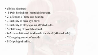• clinical features:
• 1-Pain behind ear (mastoid foramen).
• 2- affection of taste and hearing.
• 3-Inability to raise eye brow.
• 4-Inability to close eye on affected side.
• 5-Flattening of nosolabial fold.
• 6-Accumulation of food inside the cheek(affected side).
• 7-Dropping corner of mouth.
• 8-Dripping of saliva.
 