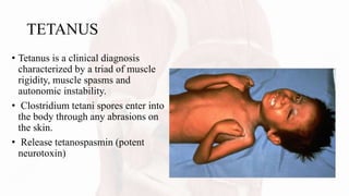 TETANUS
• Tetanus is a clinical diagnosis
characterized by a triad of muscle
rigidity, muscle spasms and
autonomic instability.
• Clostridium tetani spores enter into
the body through any abrasions on
the skin.
• Release tetanospasmin (potent
neurotoxin)
 