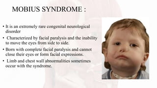 MOBIUS SYNDROME :
• It is an extremely rare congenital neurological
disorder
• Characterized by facial paralysis and the inability
to move the eyes from side to side.
• Born with complete facial paralysis and cannot
close their eyes or form facial expressions.
• Limb and chest wall abnormalities sometimes
occur with the syndrome.
 