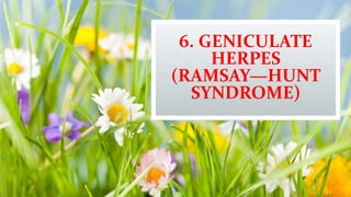 6. GENICULATE
HERPES
(RAMSAY—HUNT
SYNDROME)
 
