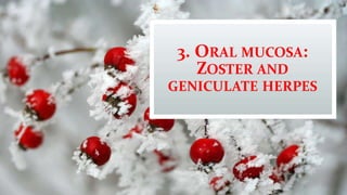 3. ORAL MUCOSA:
ZOSTER AND
GENICULATE HERPES
 