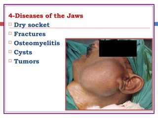 4-Diseases of the Jaws
 Dry socket
 Fractures
 Osteomyelitis
 Cysts
 Tumors
 