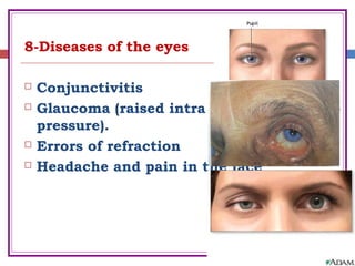 8-Diseases of the eyes
 Conjunctivitis
 Glaucoma (raised intra ocular
pressure).
 Errors of refraction
 Headache and pain in the face
 