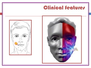 Clinical features
 