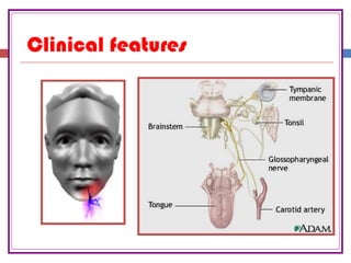 Clinical features
 