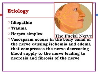 Etiology
 Idiopathic
 Trauma
 Herpes simplex
 Vasospasm occurs in the bony canal of
the nerve causing ischemia and edema
that compresses the nerve decreasing
blood supply to the nerve leading to
necrosis and fibrosis of the nerve
 