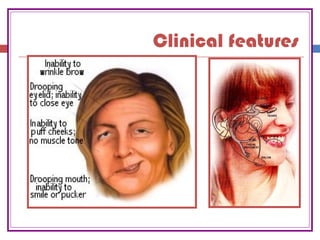 Clinical features
 