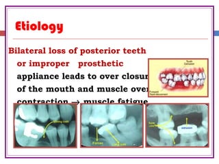 Etiology
Bilateral loss of posterior teeth
or improper prosthetic
appliance leads to over closure
of the mouth and muscle over
contraction → muscle fatigue
 