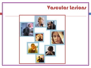Vascular Lesions
 