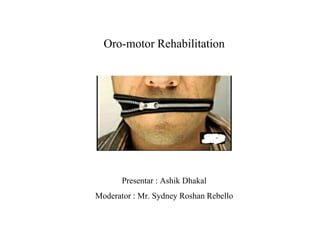 Oro-motor Rehabilitation
Presentar : Ashik Dhakal
Moderator : Mr. Sydney Roshan Rebello
 