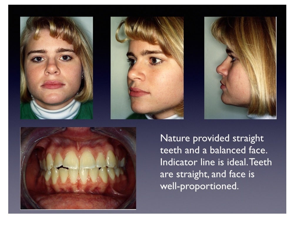 Expansion Phase
Better oxygenation 10 months later