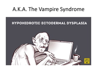 A.K.A. The Vampire Syndrome
 