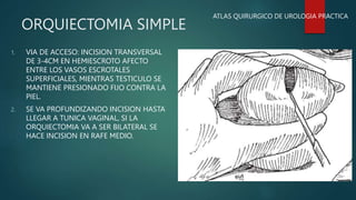 ORQUIDOPEXIA Y ORQUIECTOMIA.pptx