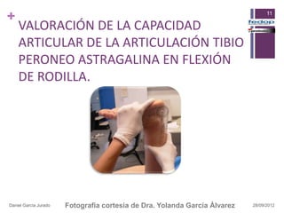 +                                                                                 11

    VALORACIÓN DE LA CAPACIDAD
    ARTICULAR DE LA ARTICULACIÓN TIBIO
    PERONEO ASTRAGALINA EN FLEXIÓN
    DE RODILLA.




Daniel García Jurado   Fotografia cortesia de Dra. Yolanda García Álvarez   28/09/2012
 