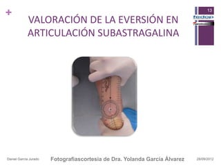 +                                                                                 13

            VALORACIÓN DE LA EVERSIÓN EN
            ARTICULACIÓN SUBASTRAGALINA




Daniel García Jurado   Fotografiascortesia de Dra. Yolanda García Álvarez   28/09/2012
 