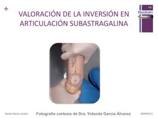 +                                                                                 14

           VALORACIÓN DE LA INVERSIÓN EN
           ARTICULACIÓN SUBASTRAGALINA




Daniel García Jurado   Fotografía cortesía de Dra. Yolanda García Álvarez   28/09/2012
 
