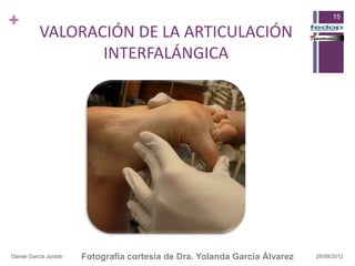 +                                                                                 15

          VALORACIÓN DE LA ARTICULACIÓN
                 INTERFALÁNGICA




Daniel García Jurado   Fotografia cortesia de Dra. Yolanda García Álvarez   28/09/2012
 