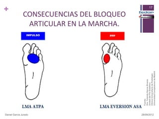 +




Daniel García Jurado
                                                            IMPULSO
                                                            ppp
                                                                       ARTICULAR EN LA MARCHA.
                                                                      CONSECUENCIAS DEL BLOQUEO




                       Fuente:
                       Dra. Yolanda García Álvarez
                       Unidad del Pie Diabético
                                                                                                  17




                       Clínica Universitaria de Podología
28/09/2012




                       Universidad Complutense de Madrid
 