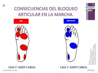 +




Daniel García Jurado
                                                            ppp
                                                                       ARTICULAR EN LA MARCHA.
                                                            IMPULSO
                                                                      CONSECUENCIAS DEL BLOQUEO




                       Fuente:
                       Dra. Yolanda García Álvarez
                       Unidad del Pie Diabético
                                                                                                  18




                       Clínica Universitaria de Podología
28/09/2012




                       Universidad Complutense de Madrid
 