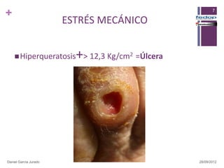 +                                                             7

                       ESTRÉS MECÁNICO


     Hiperqueratosis    +> 12,3 Kg/cm   2   =Úlcera




Daniel García Jurado                                   28/09/2012
 