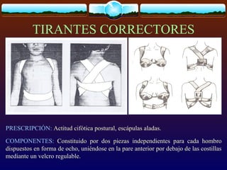 TIRANTES CORRECTORES
PRESCRIPCIÓN: Actitud cifótica postural, escápulas aladas.
COMPONENTES: Constituido por dos piezas independientes para cada hombro
dispuestos en forma de ocho, uniéndose en la pare anterior por debajo de las costillas
mediante un velcro regulable.
 