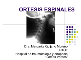 ORTESIS ESPINALES 
Dra. Margarita Quijano Moreno 
R4OT 
Hospital de traumatologia y ortopedia 
“Lomas Verdes” 
 