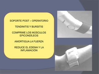 SOPORTE POST – OPERATORIO
TENDINITIS Y BURSITIS
COMPRIME LOS MÚSCULOS
EPICONDÍLEOS
AMORTIGUA LA FUERZA
REDUCE EL EDEMA Y LA
INFLAMACIÓN
 