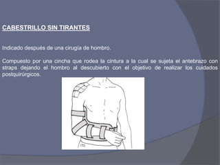 CABESTRILLO SIN TIRANTES
Indicado después de una cirugía de hombro.
Compuesto por una cincha que rodea la cintura a la cual se sujeta el antebrazo con
straps dejando el hombro al descubierto con el objetivo de realizar los cuidados
postquirúrgicos.
 