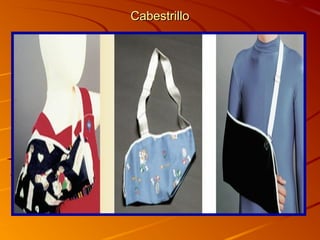 CCaabbeessttrriilllloo 
 