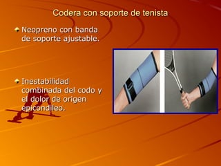 CCooddeerraa ccoonn ssooppoorrttee ddee tteenniissttaa 
NNeeoopprreennoo ccoonn bbaannddaa 
ddee ssooppoorrttee aajjuussttaabbllee.. 
IInneessttaabbiilliiddaadd 
ccoommbbiinnaaddaa ddeell ccooddoo yy 
eell ddoolloorr ddee oorriiggeenn 
eeppiiccoonnddiilleeoo.. 
 
