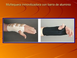 Muñequera inmovilizadora ccoonn bbaarrrraa ddee aalluummiinniioo 
 